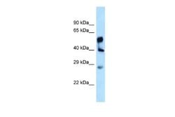 LPGAT1 Rabbit anti-Human, Polyclonal, Novus Biologicals 0.1 mL | Buy Online | Novus Biologicals | Fisher Scientific